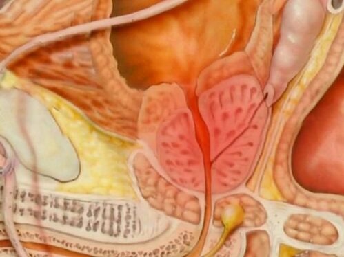Le type de prostate sain d'une personne